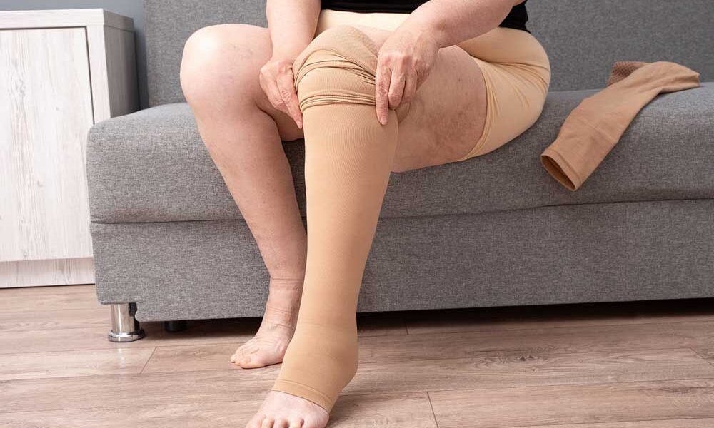 patient wearing compression stockings for varicose veins